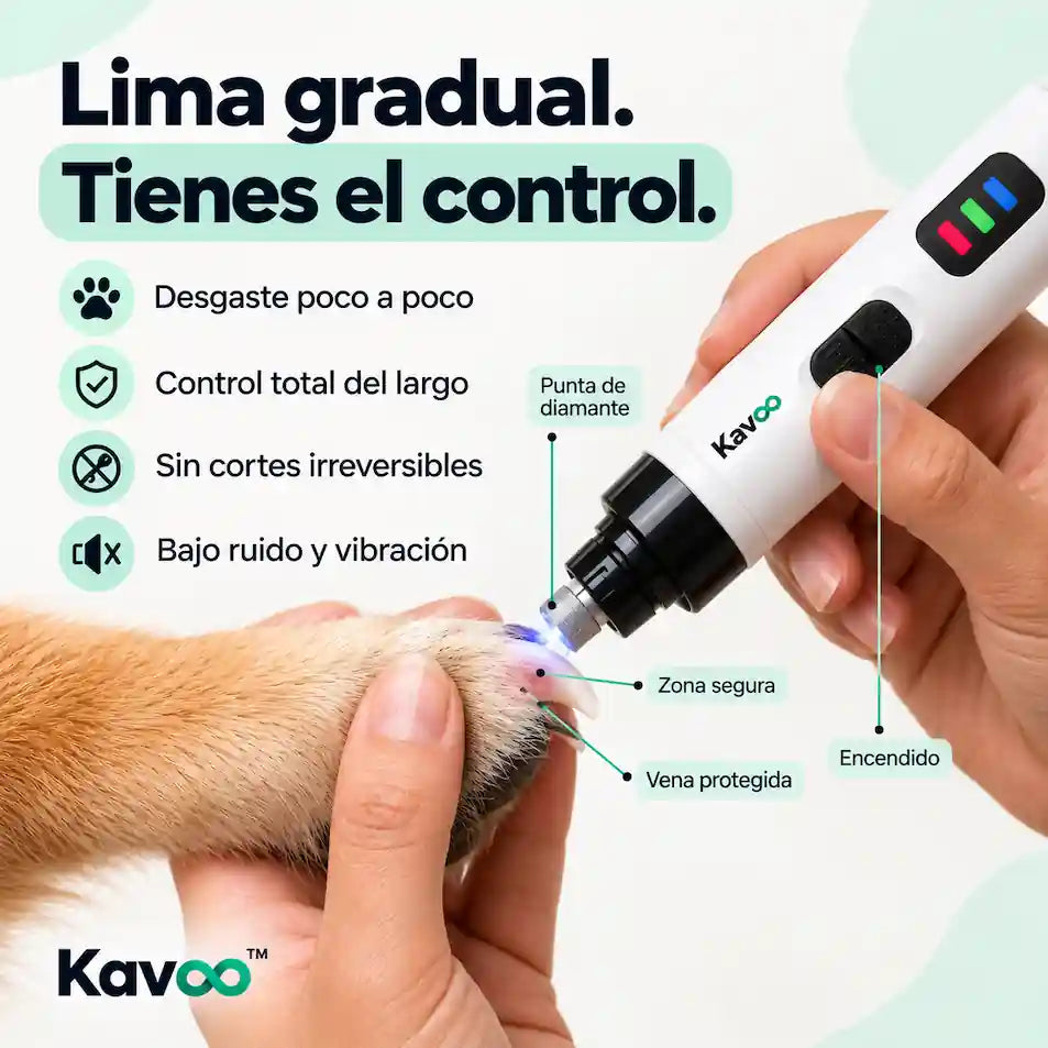 Kavoo™ Molinillo de Uñas Silencioso