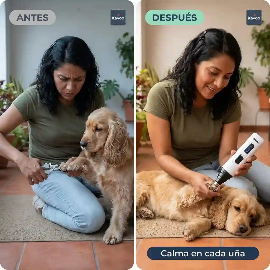 Kavoo™ Molinillo de Uñas Silencioso